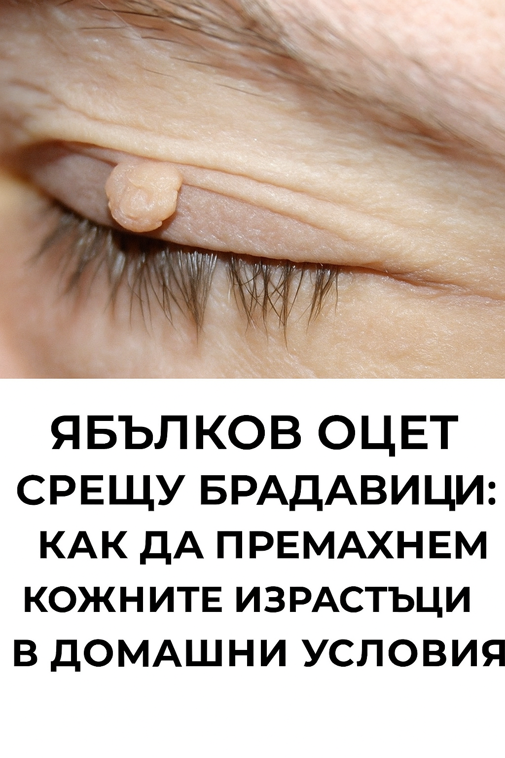 20251026 1456 yabalkov oczet i